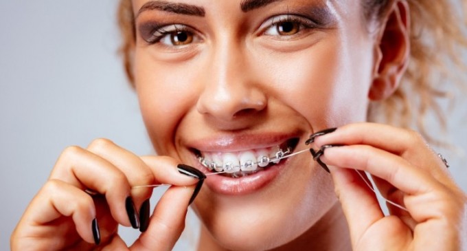 Aparat dentar – 5 reguli de aur pentru curățare și igienizare