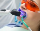 Procesul de albire dentară profesională: Ce trebuie să știți